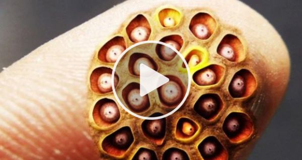 Why Doctors In The Know No Longer Prescribe Metformin