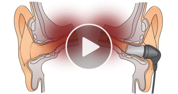 Top Doctor: Do This To Relieve Tinnitus & Fight Ringing Ears (Watch Video)