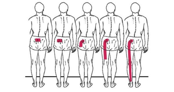 What Vitamin Causes Immediate Relief From Sciatic Nerve Pain?