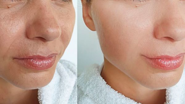 This Skin Tightening Cream Sold Out At Target (In Just 2 Days)