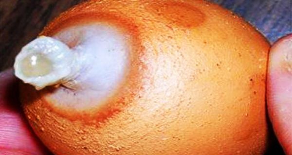 Stop Using Metformin. Here's Why