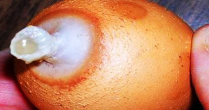 Stop Using Metformin. Here's Why