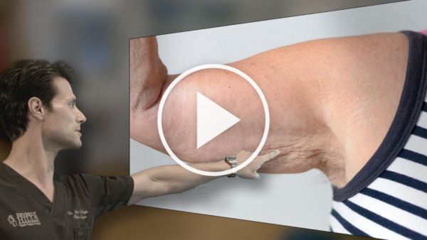 Skin Doctor Begs America: "Do This Every Morning To Lift Sagging Skin"