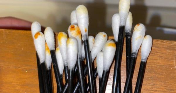 Simple Trick To Easily Remove Earwax