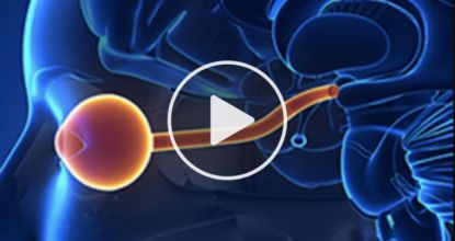 Eye Doctor: THIS Revolutionary 6-Second Trick Restores Perfect Eyesight